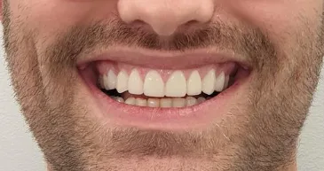 After treatment — A new smile
