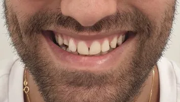Before treatment — A new smile