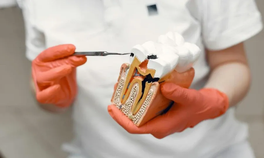 Cross-section model of a tooth showing the roots and the jawbone